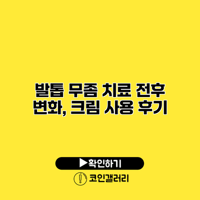 발톱 무좀 치료 전후 변화, 크림 사용 후기